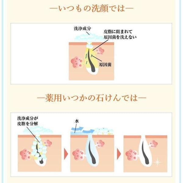 P-3-MZH-ITS-MS-100-Mizuhashi Hojyudo Itsukano Sekken Medical Soap Bar 100g.jpg